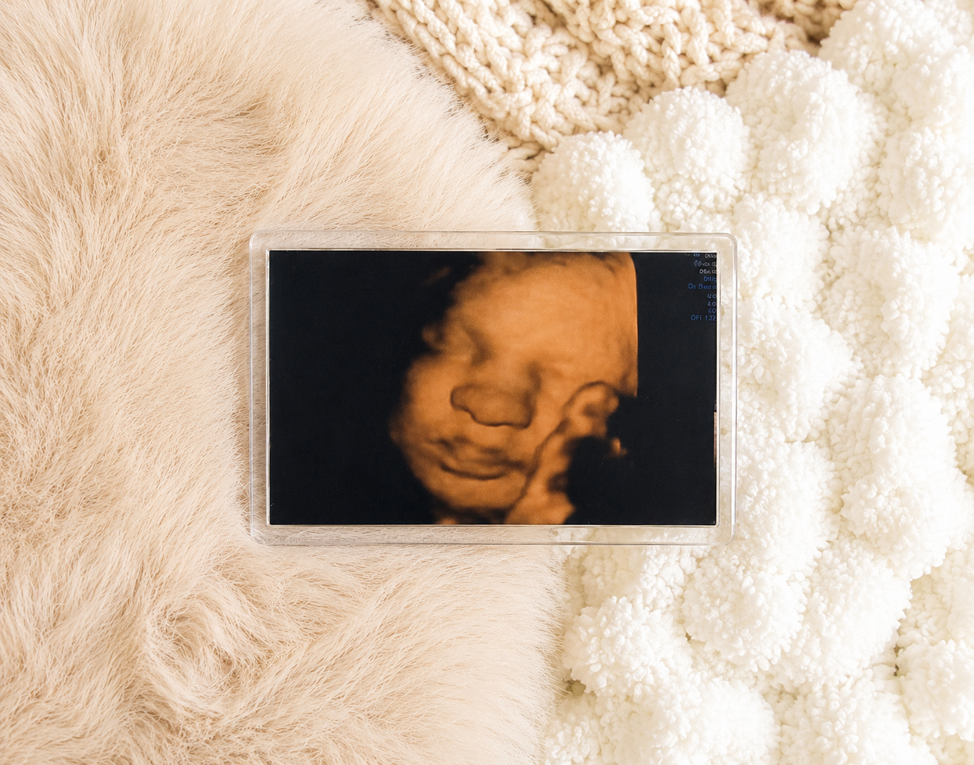 Scan Photo Fridge Magnet