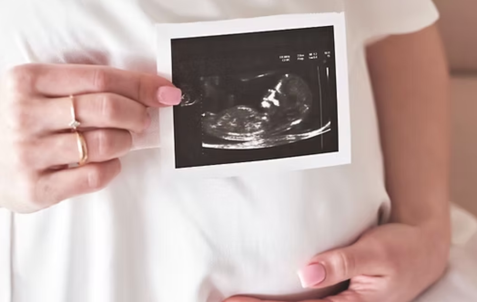 Person holding an ultrasound scan in front of a white shirt
