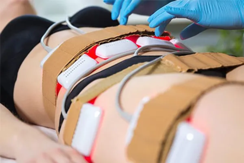 A woman is getting a laser treatment on her stomach. Showcasing a Fit n Tan St Louis service.