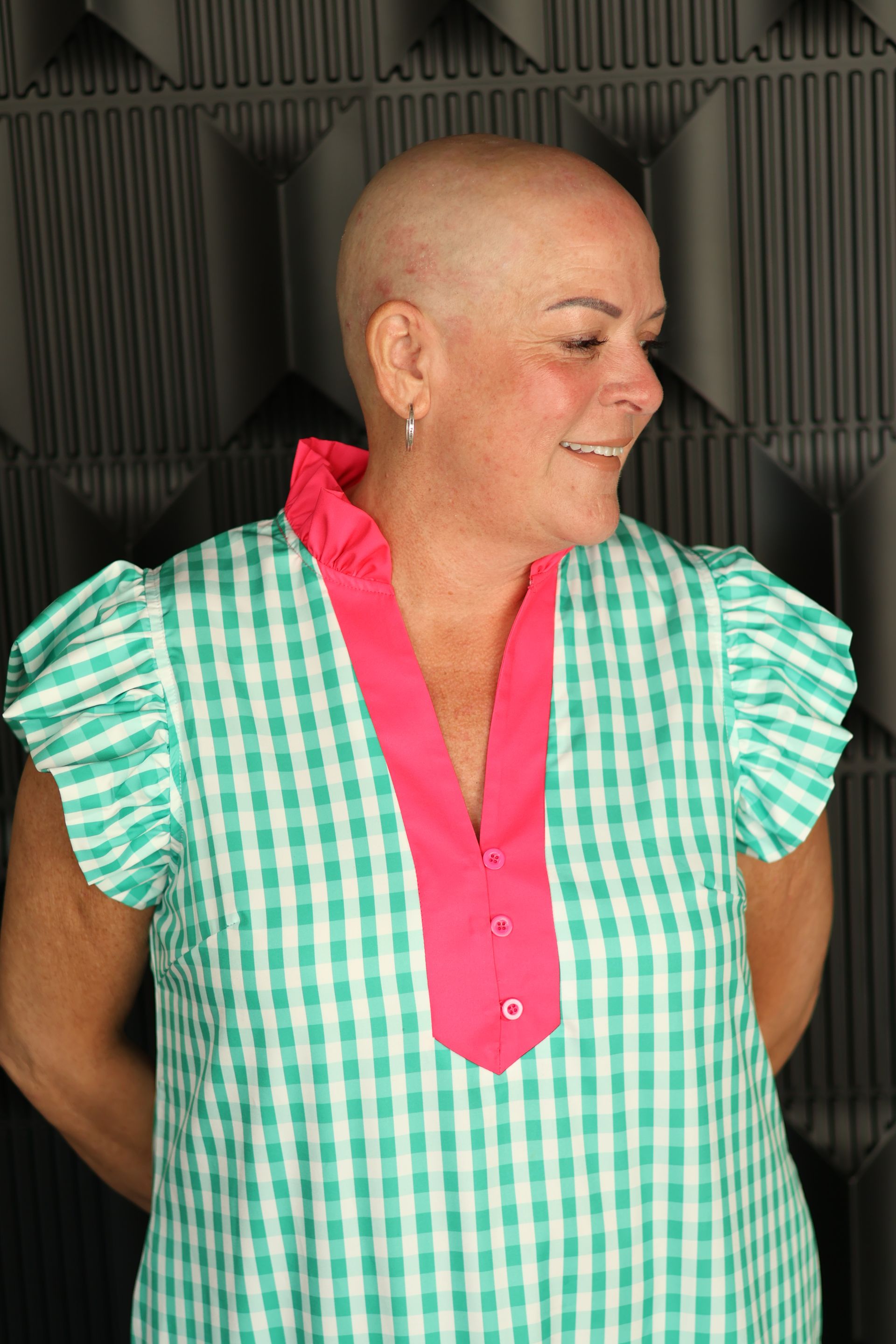 Woman experiencing cancer-related hair loss before receiving her custom wig