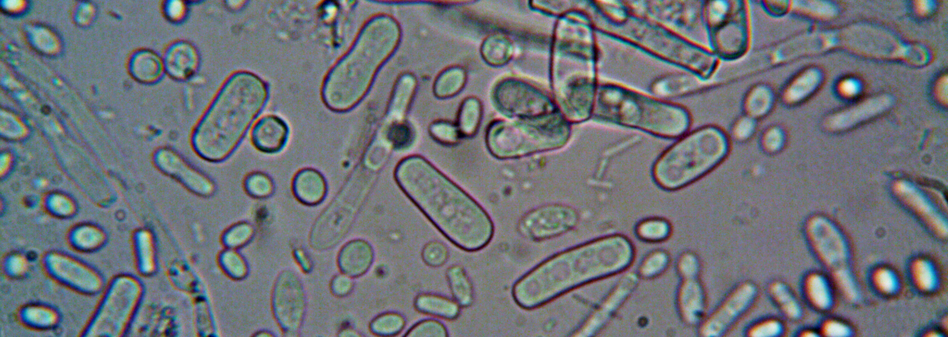 Microscopic view of elongated oval cells in a translucent fluid, some with dark outlines and specks