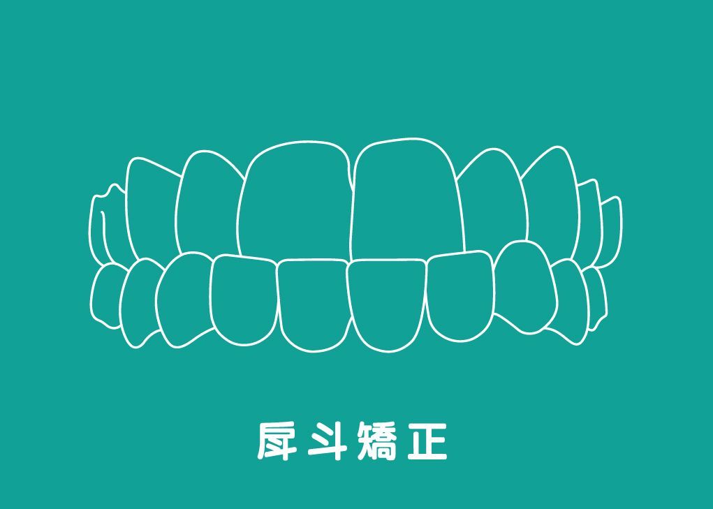 戽 斗Crossbite