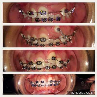 DS ODONTOS