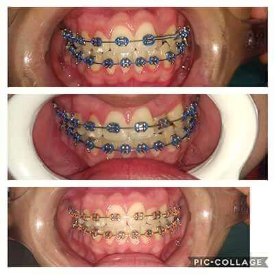 DS ODONTOS