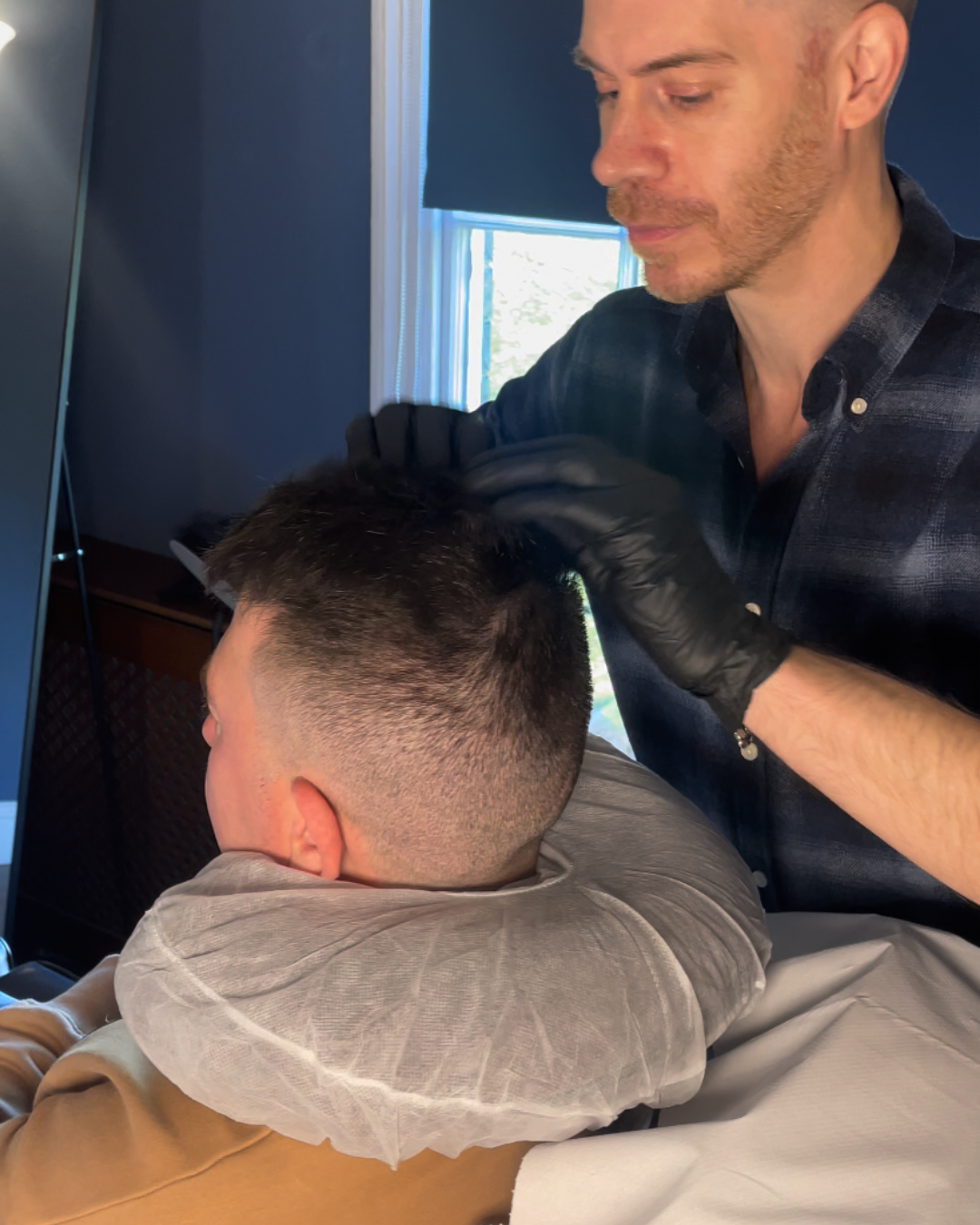 mens smp on hair transplant