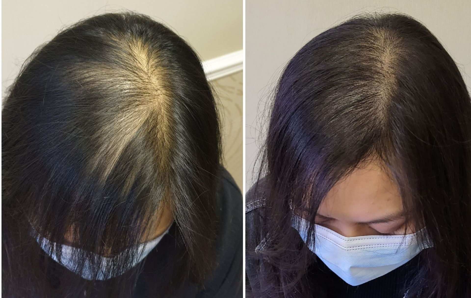 SMP Before and After Results