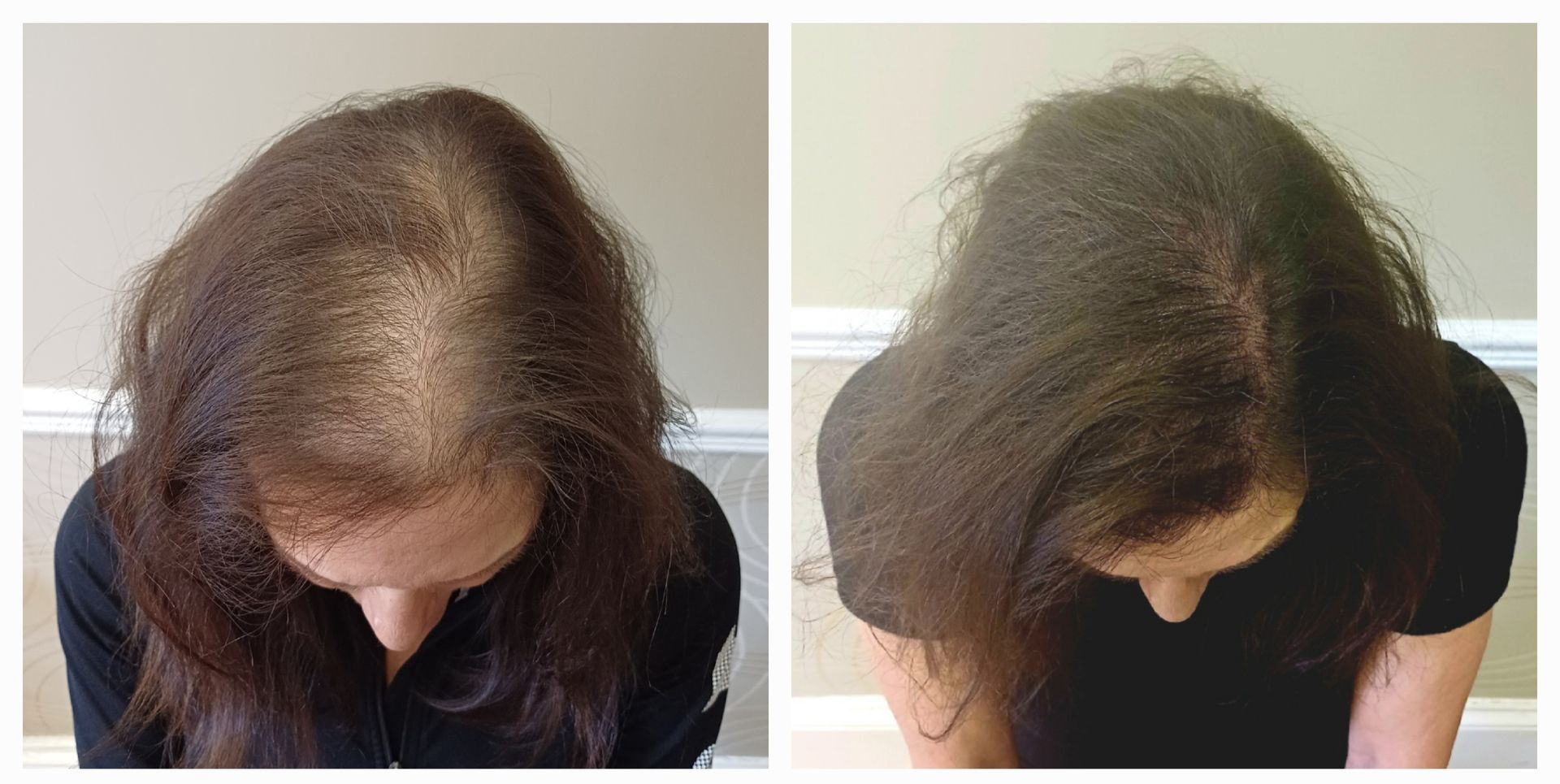 A before and after of a micropigmentation client