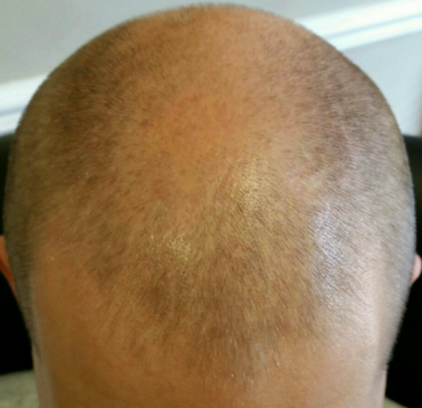 Density effect with SMP before