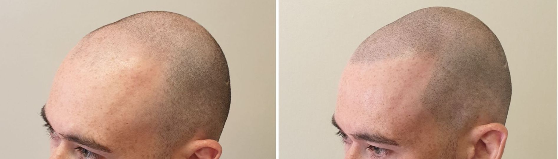 Hair tattoo for men