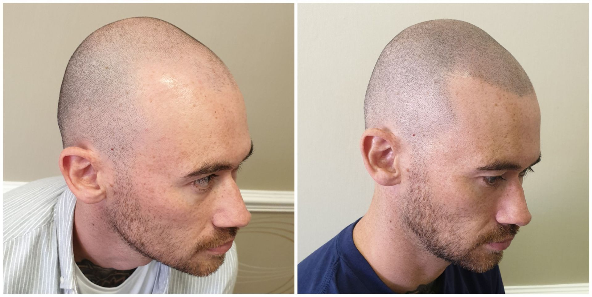 SMP Before and After Results