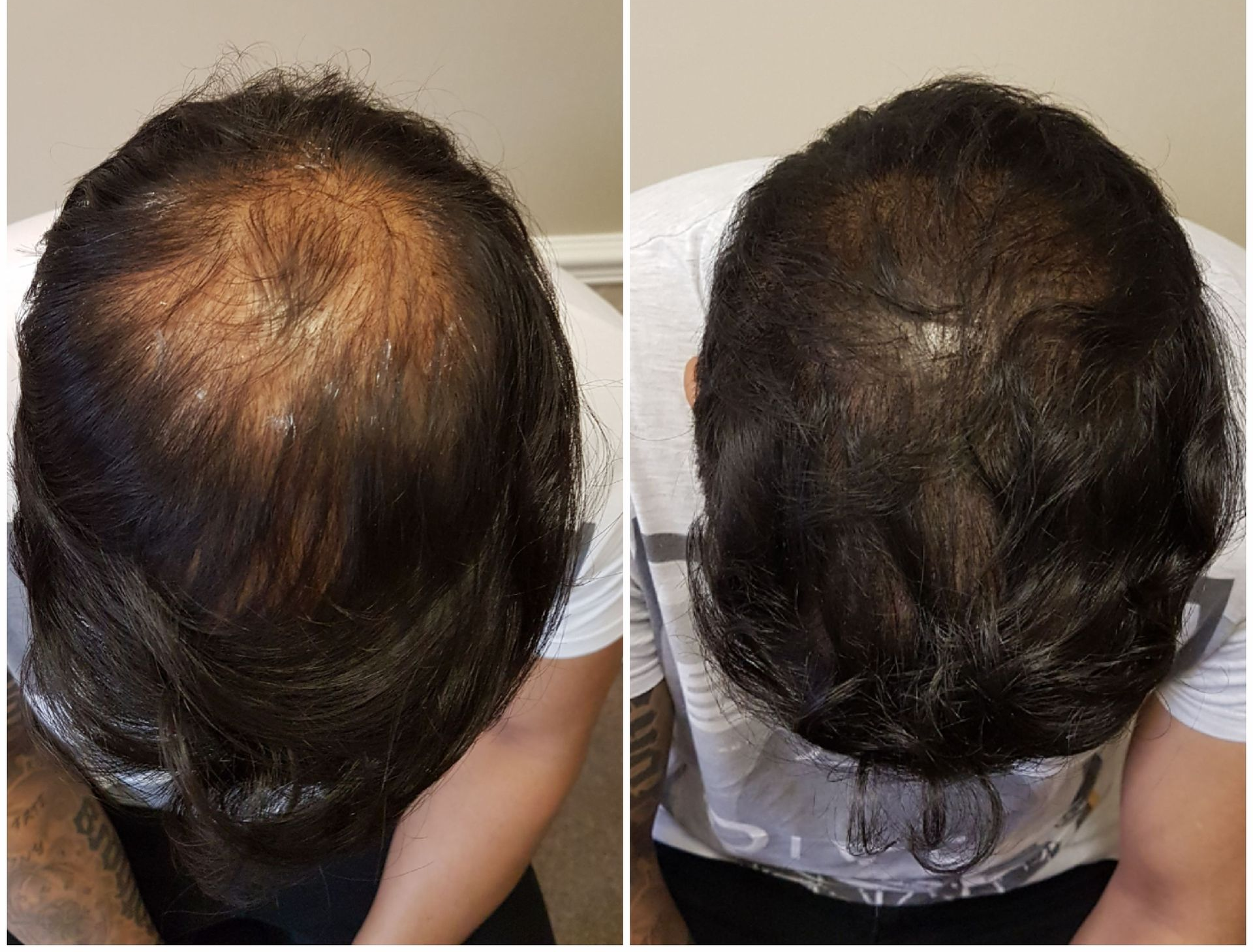 SMP Before and After Results