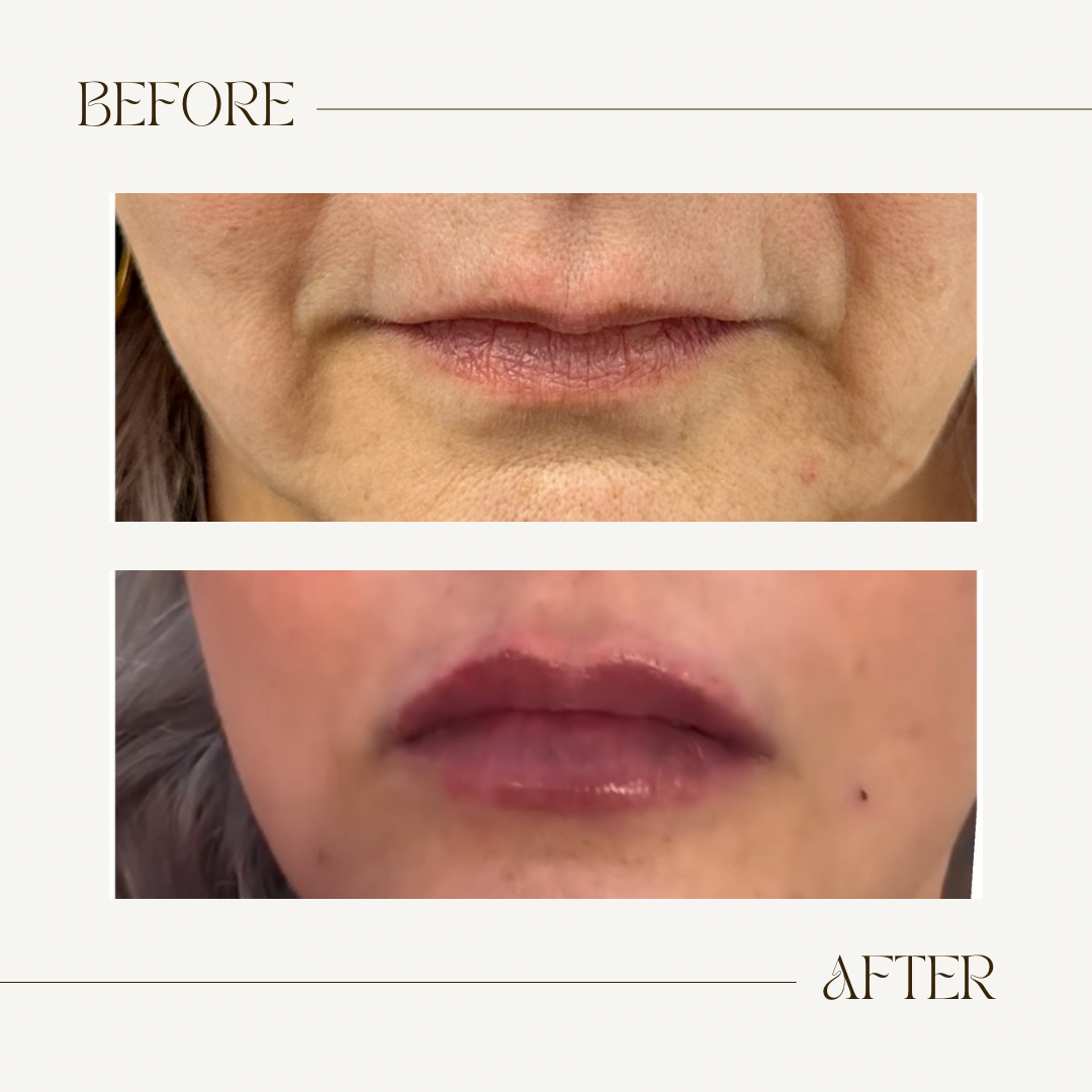 A before and after photo of a woman 's lips.