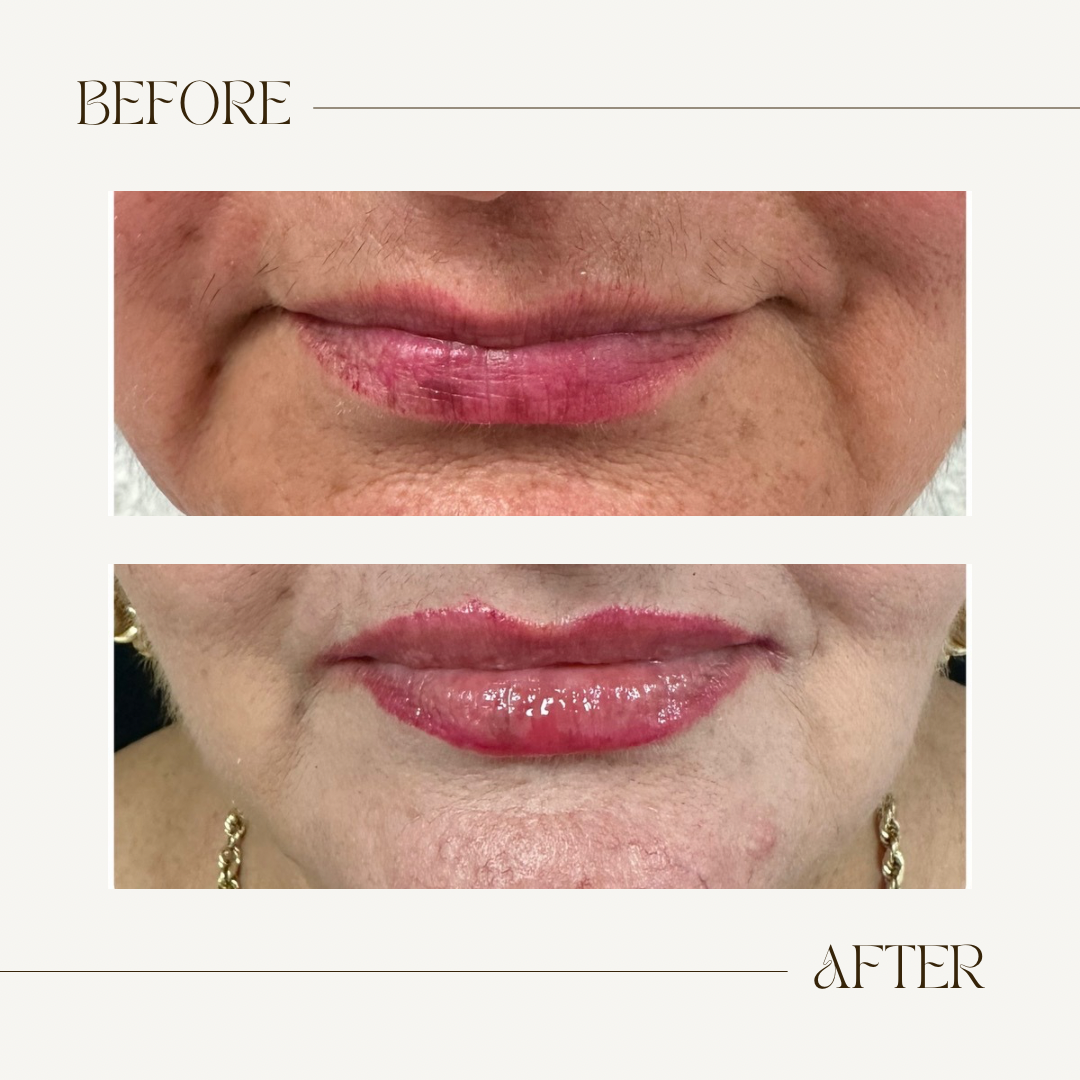 A before and after photo of a woman 's lips.