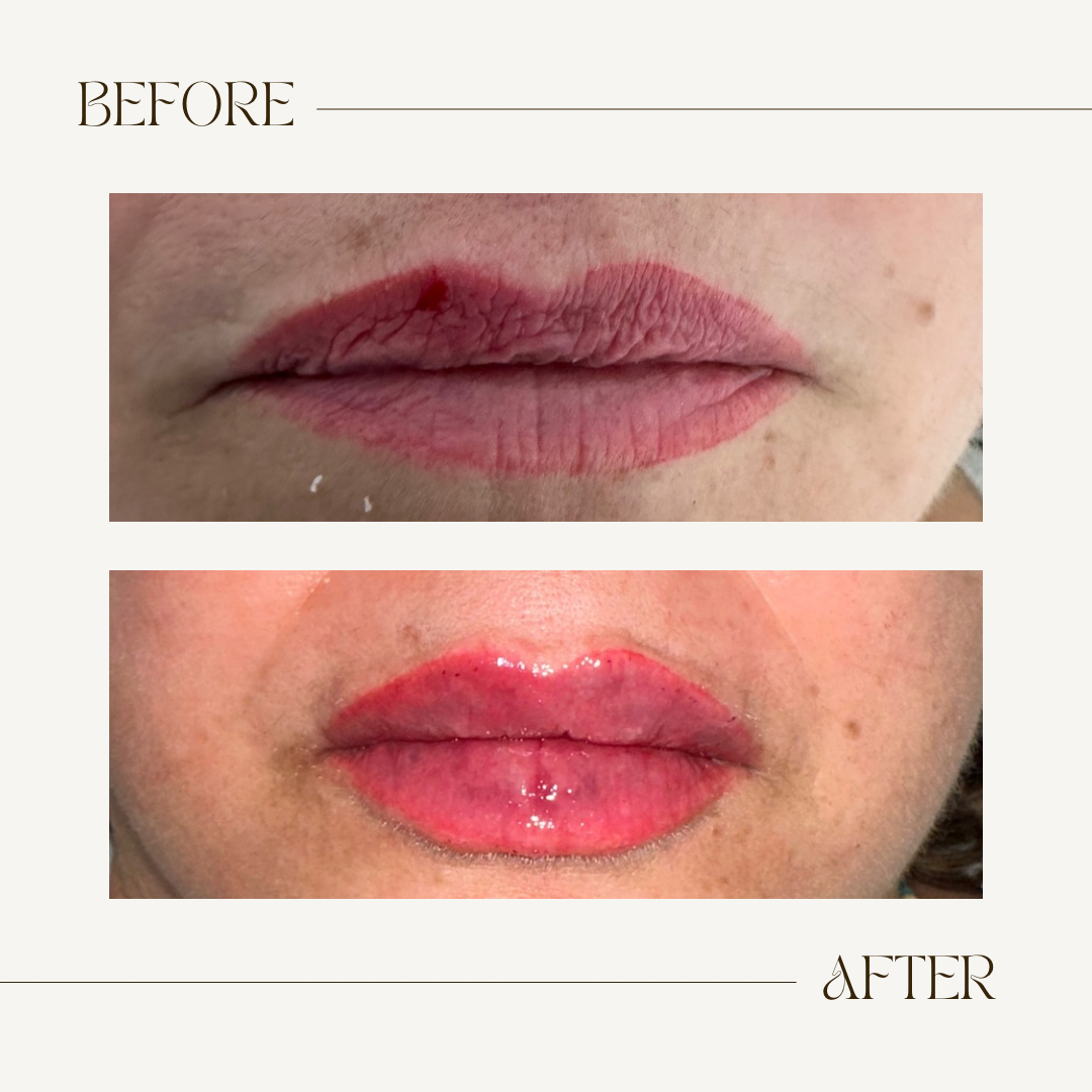 A before and after picture of a woman 's lips.