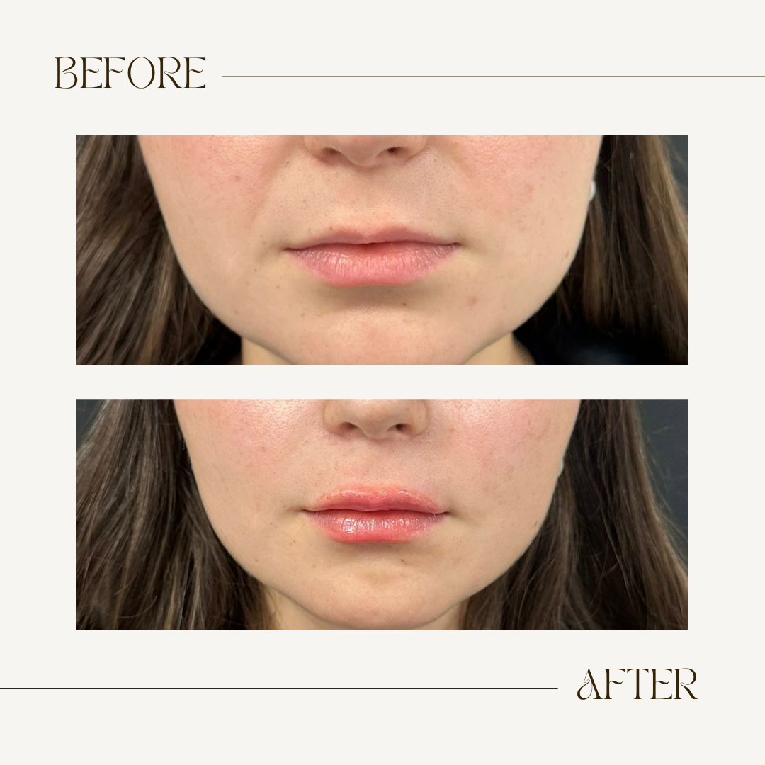 A before and after photo of a woman 's face