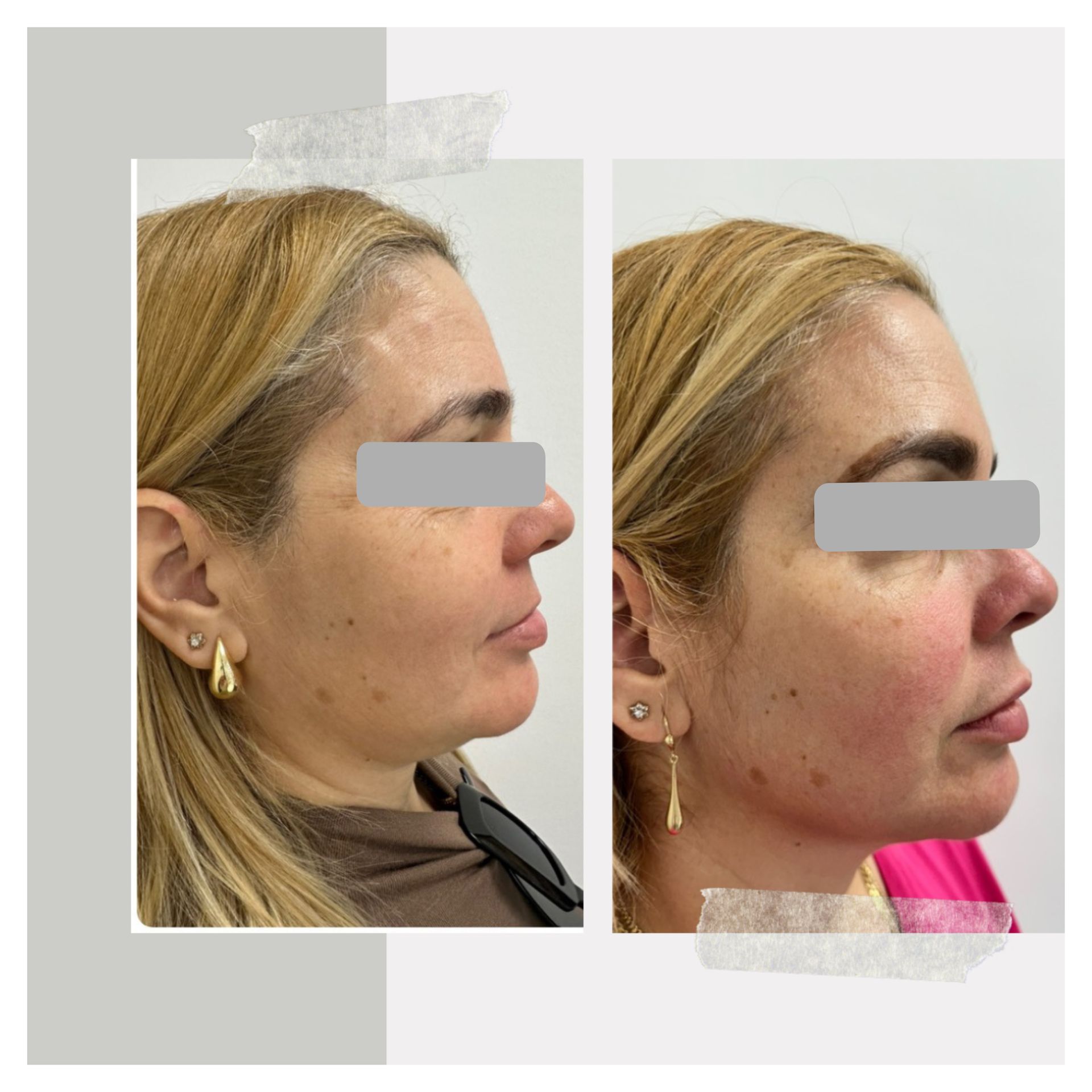 A before and after photo of a woman 's face