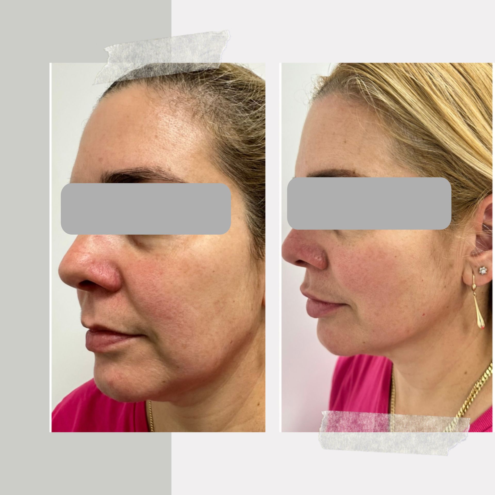 A before and after photo of a woman 's face.