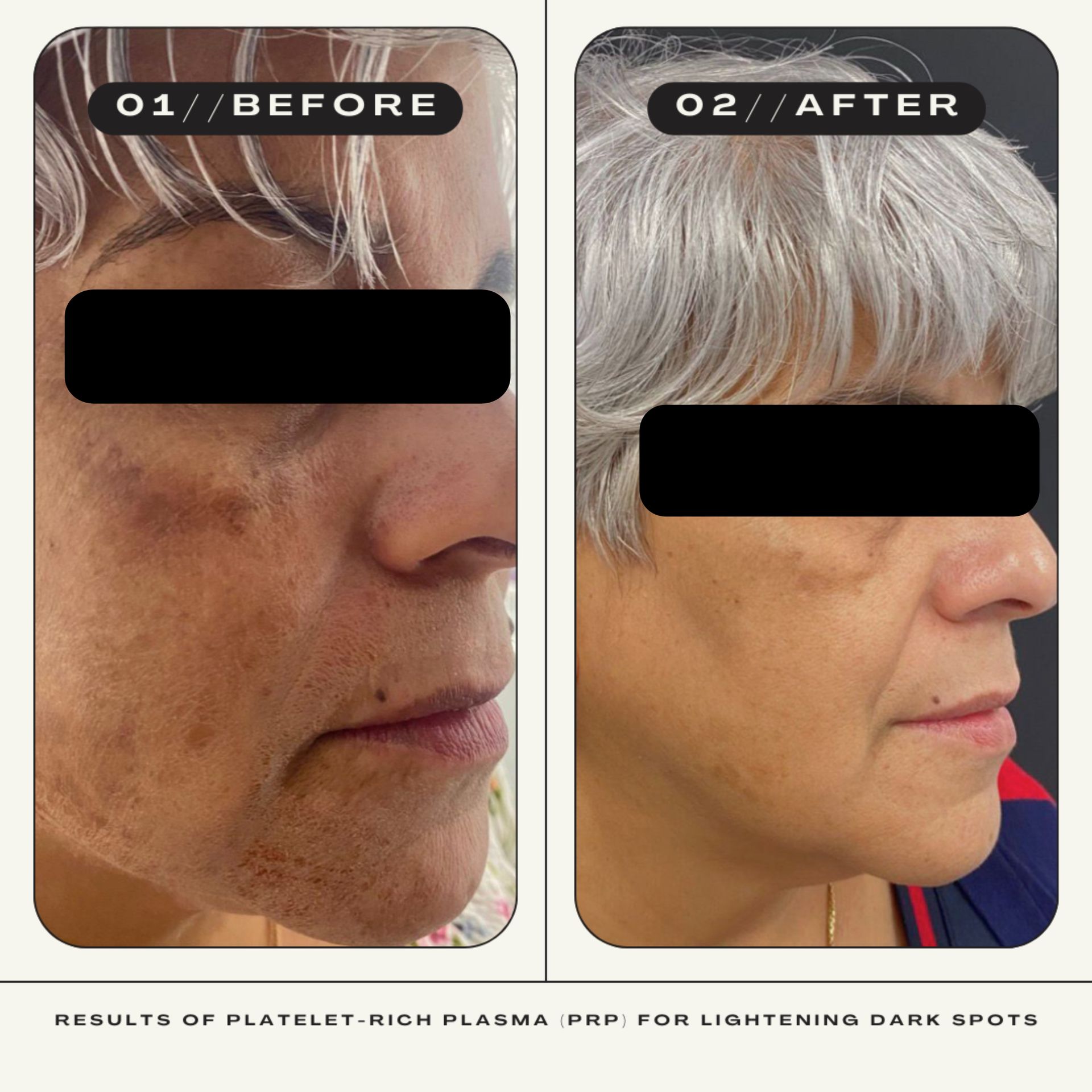 A before and after photo of a woman 's face