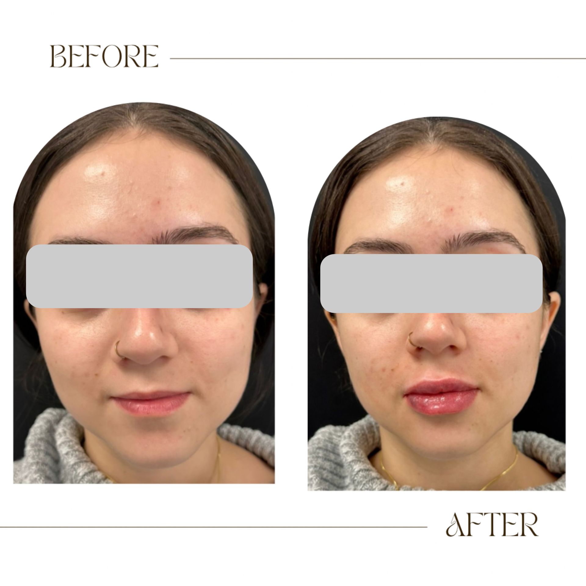 A before and after photo of a woman 's face.