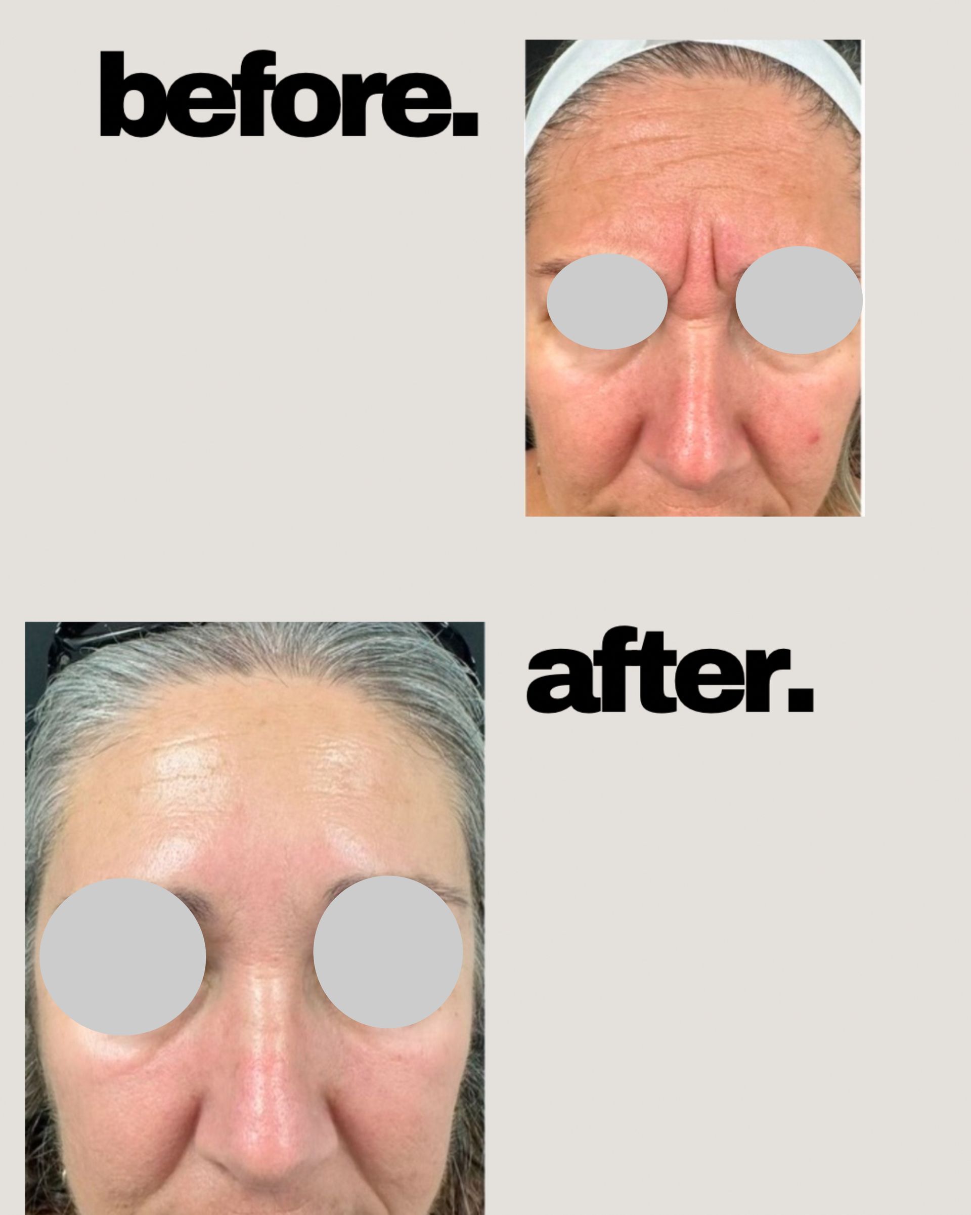 A before and after photo of a woman 's face