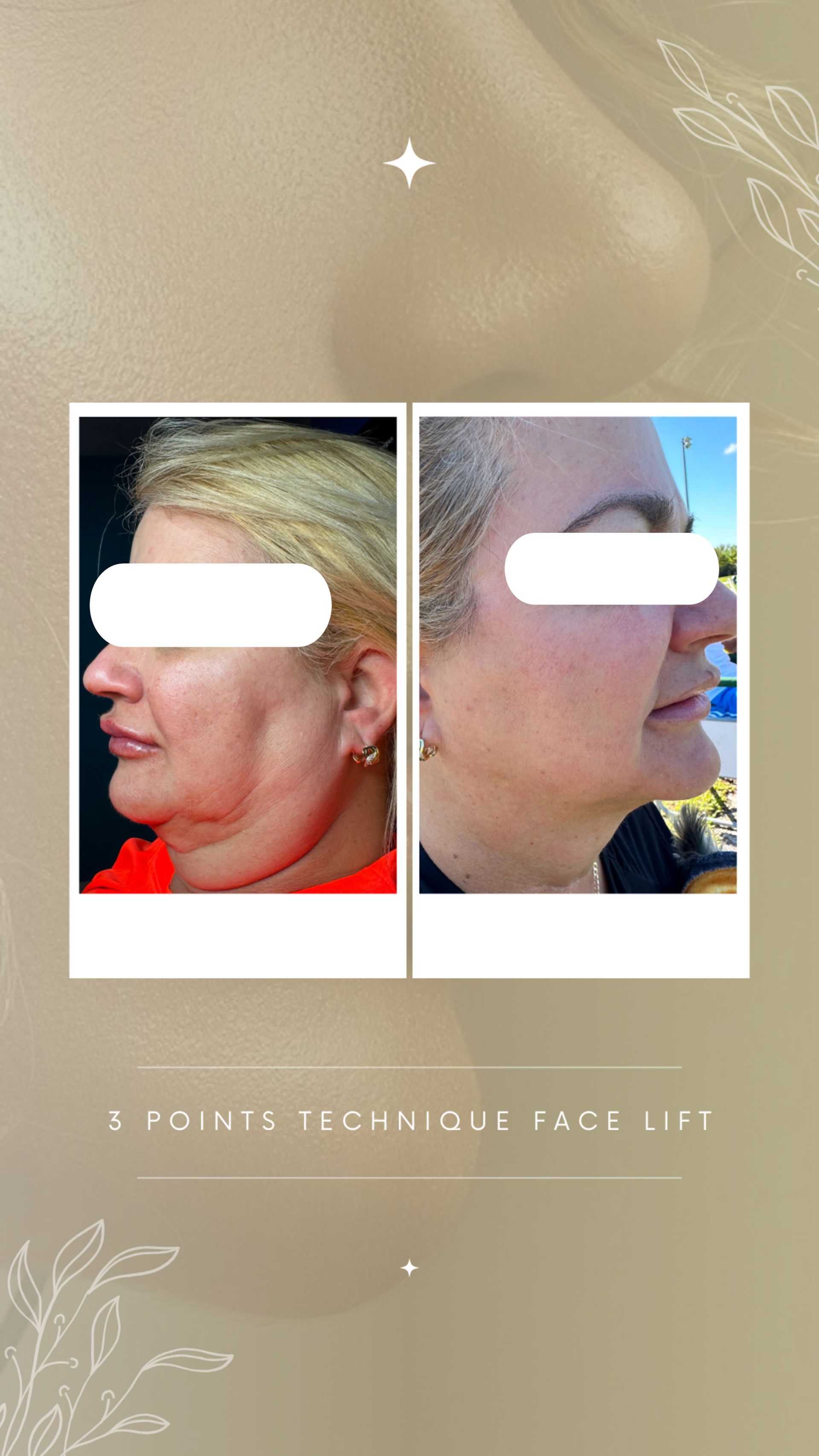 A before and after photo of a woman 's face.