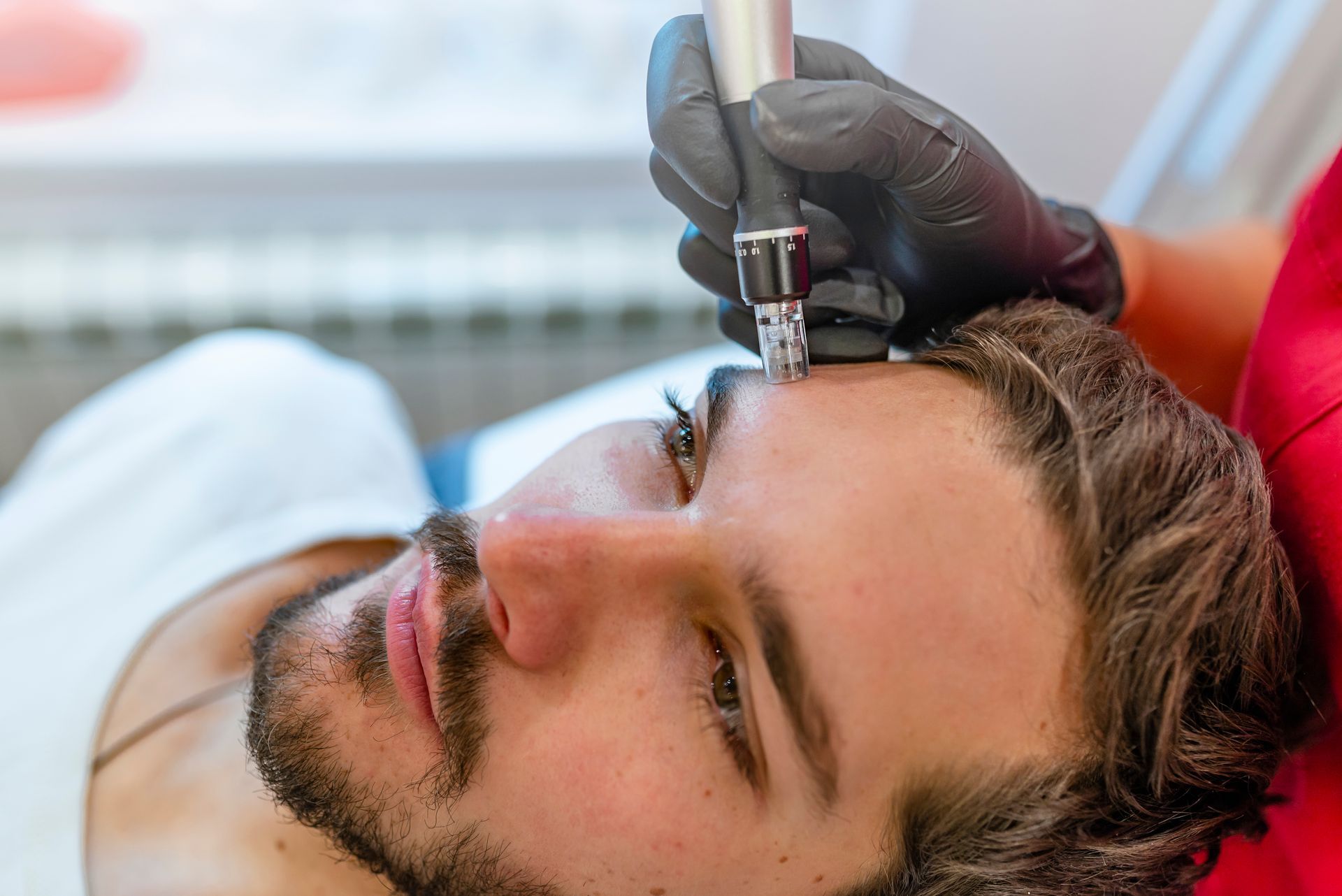 A man is getting a microdermabrasion treatment on his forehead.