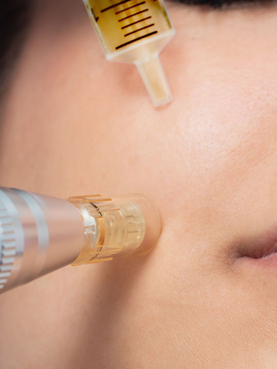 A woman is getting a facial treatment with a syringe.