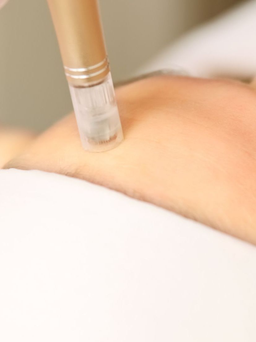 A person is getting a laser treatment on their arm.