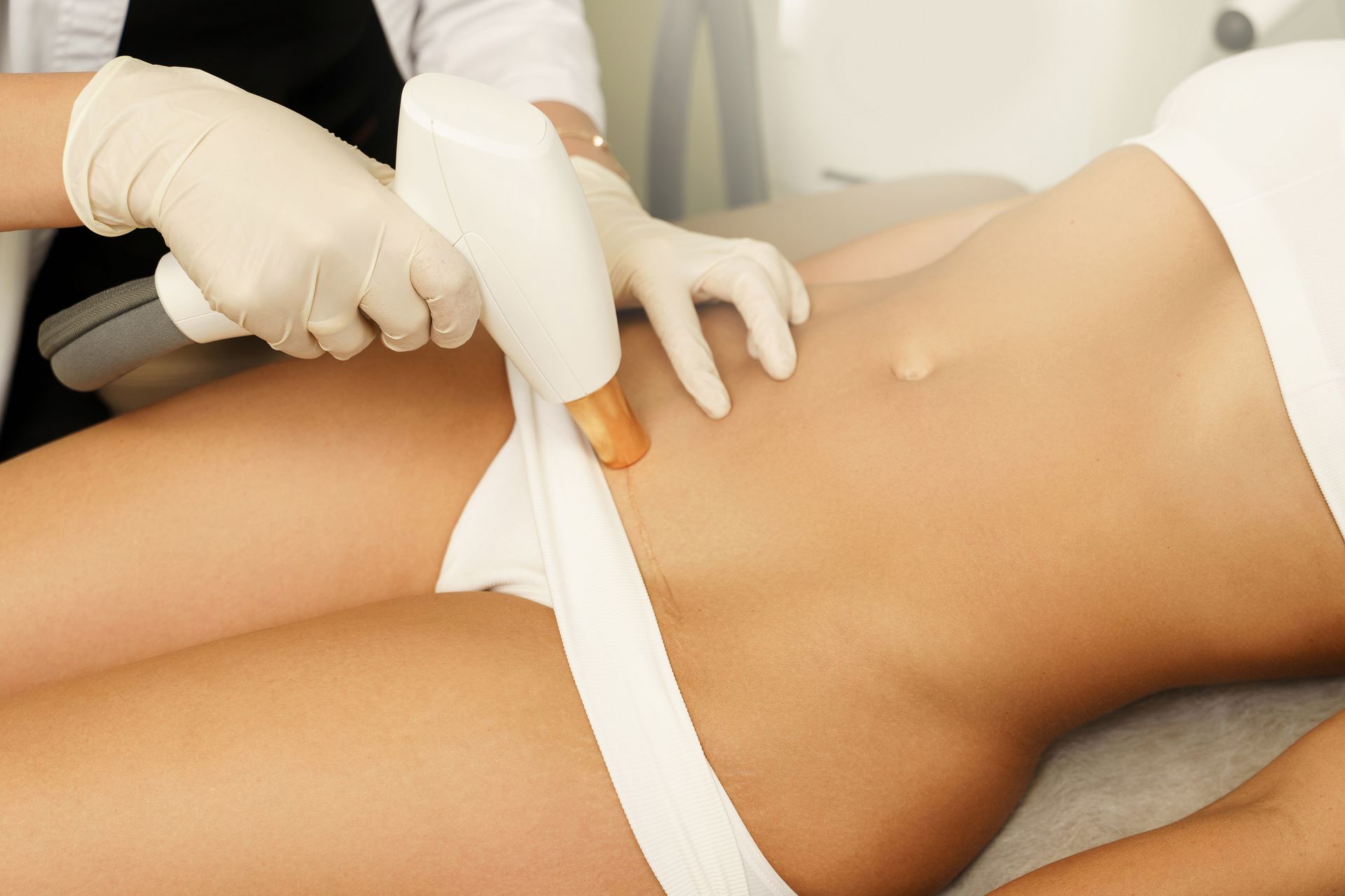 A woman is getting a laser hair removal treatment on her stomach.