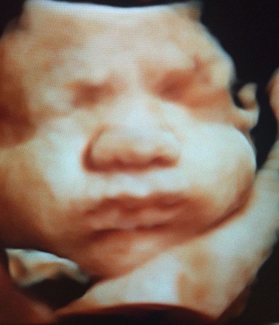 Baby scan image 5