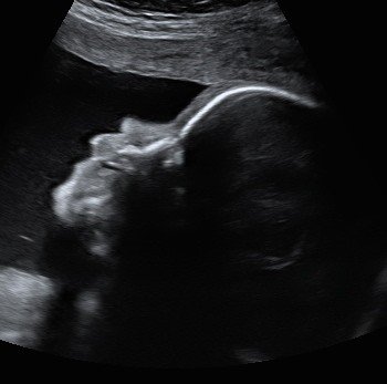 Baby scan image 11