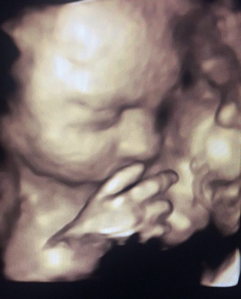 Baby scan image 9