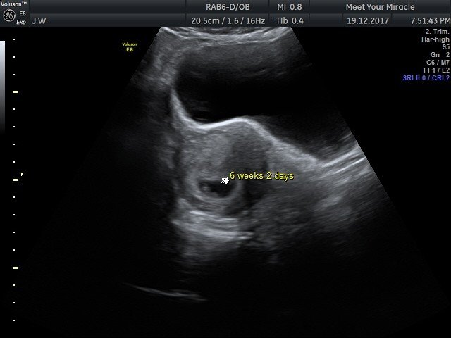 Baby scan image 10