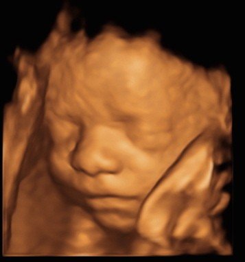 Baby scan image 4