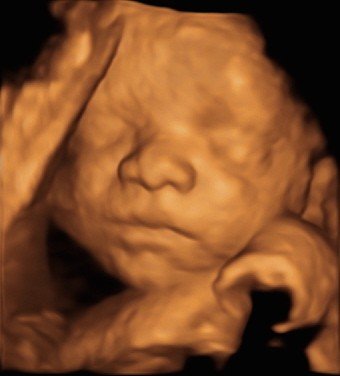 Baby scan image 2