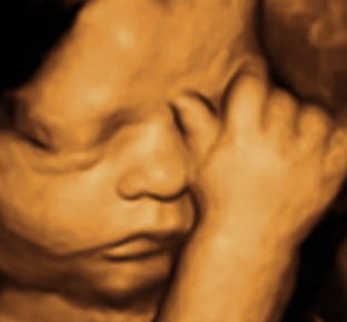 Baby scan image 3