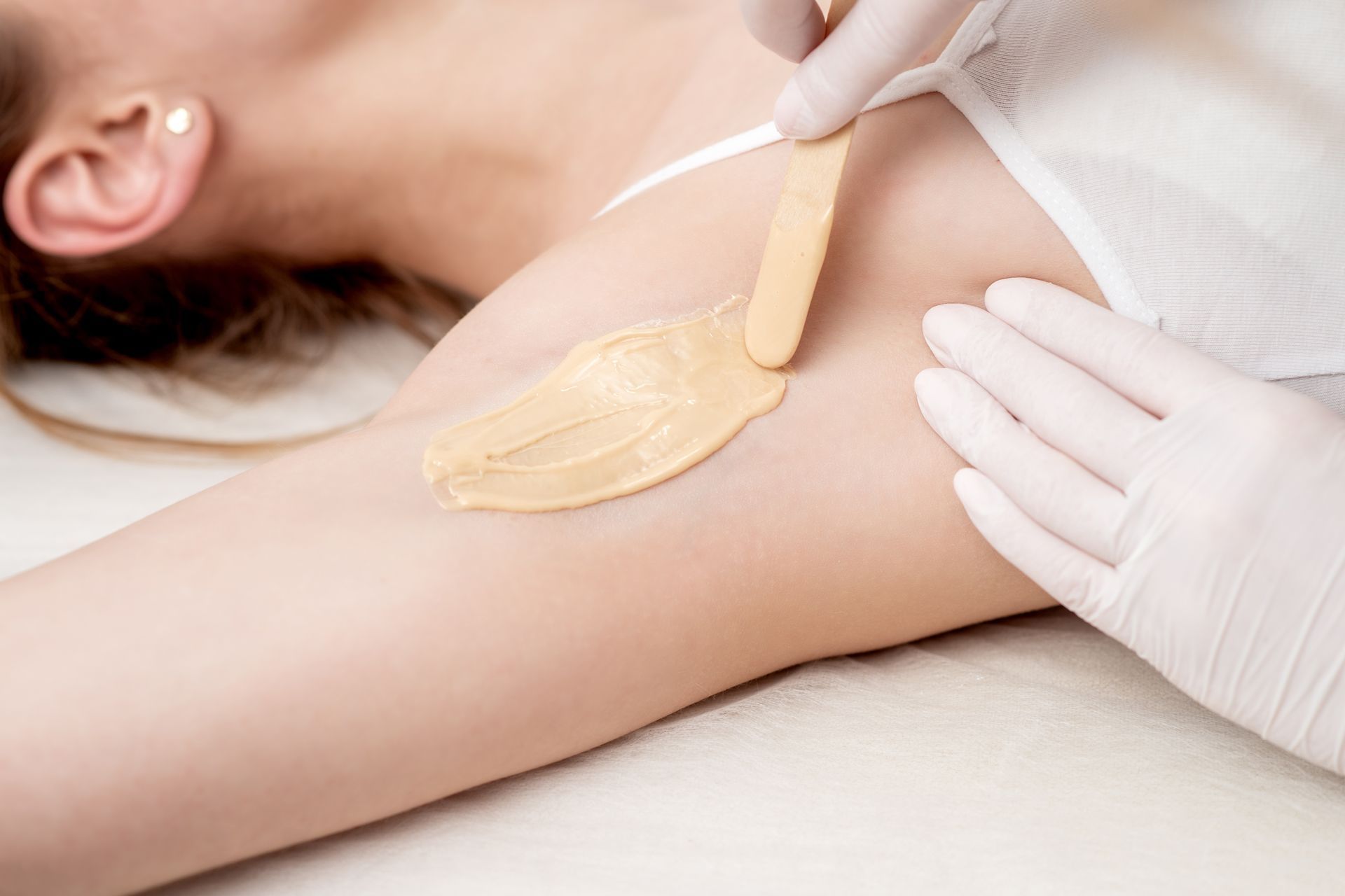 Gloved hands applying wax to a person's underarm during hair removal treatment