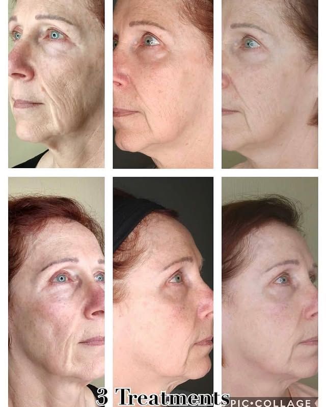 Spa facial treatment with a woman lying down as hands apply a cream facial mask