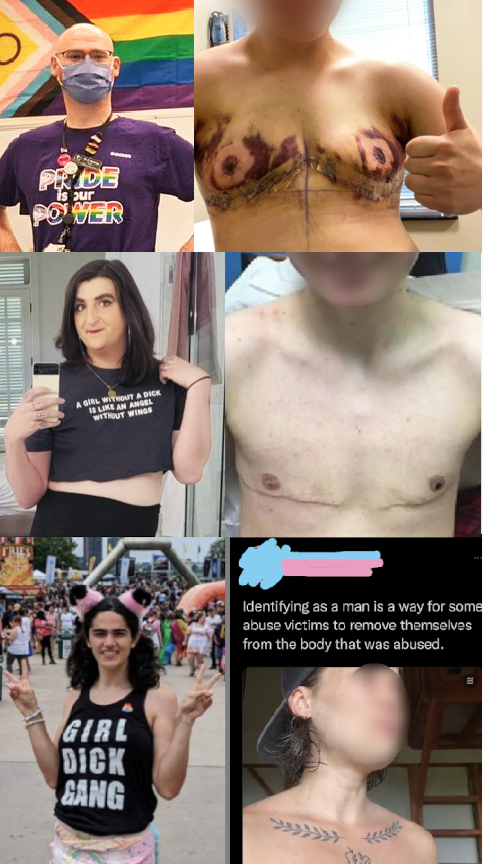 Collage of people with chest scars and tattoos, plus a protest photo and quoted text on a black background