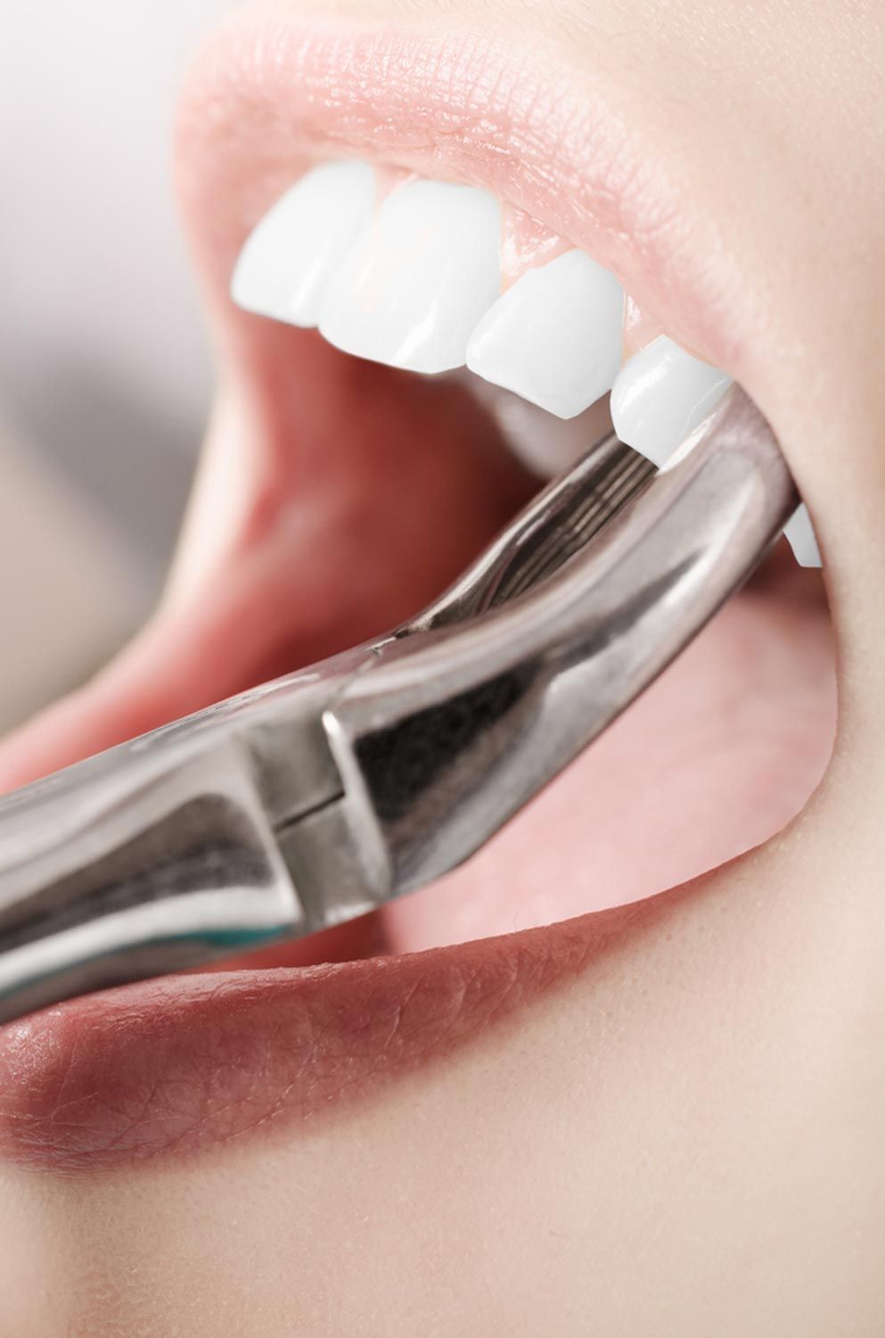 Natural-looking dentures and tooth replacement solutions on the Central Coast