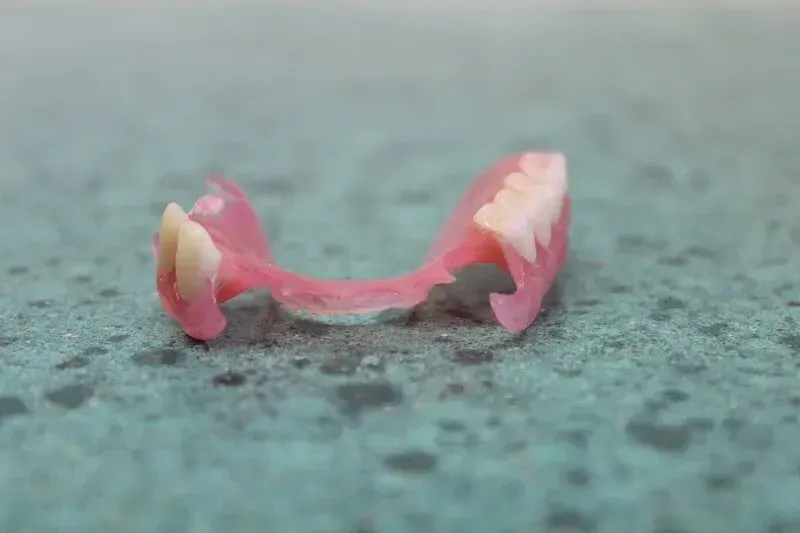 lower jaw partial denture — Dentures in Toukley, NSW