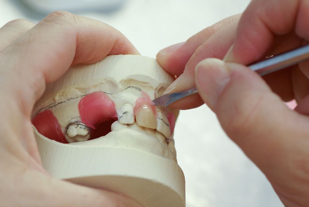 A Dentist Repairing A Denture