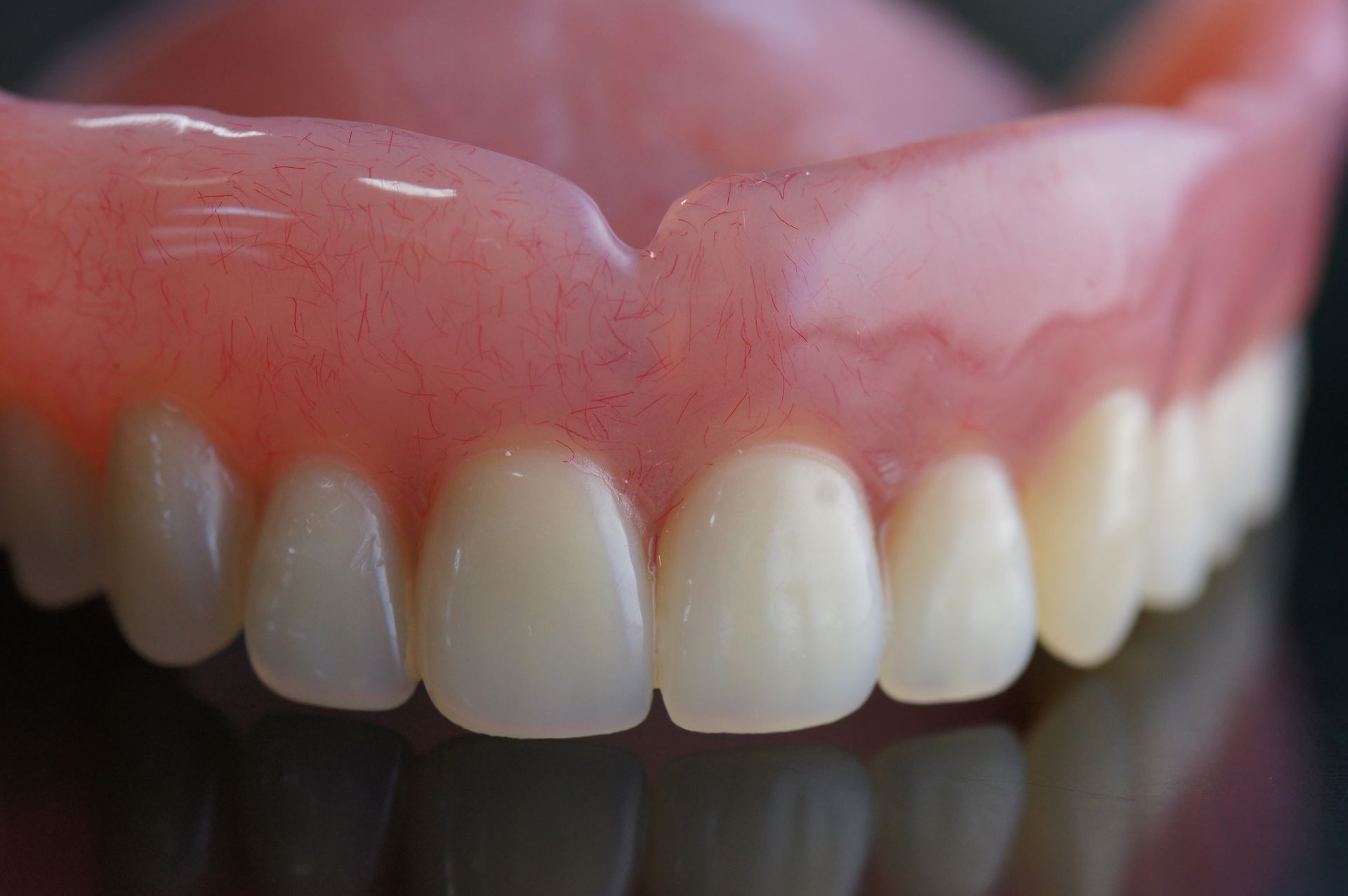 Close-up of a Set of Upper Dentures