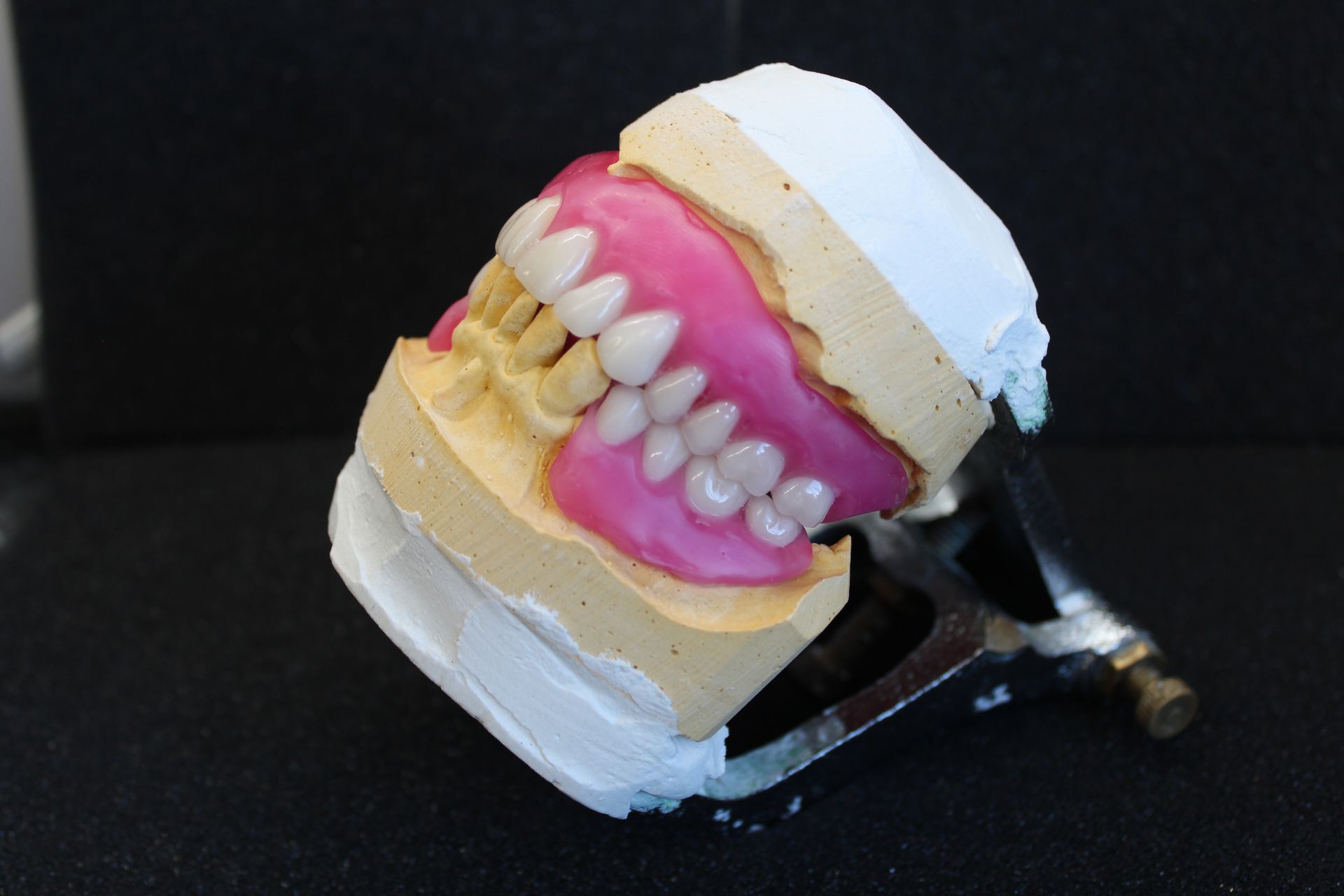 Custom denture mould being fitted at Toukley Denture Clinic on the Central Coast