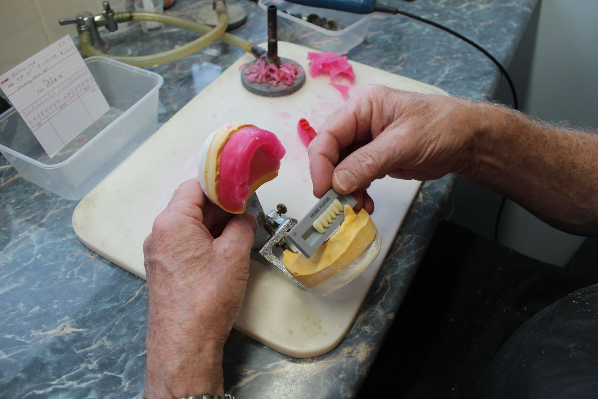 Men working on a partial denture — Dentures in Toukley, NSW