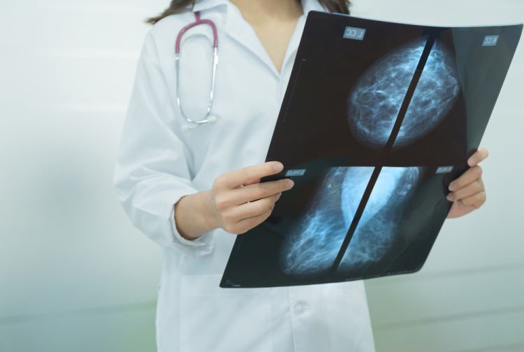 A healthcare professional in a white coat holding up mammogram X-ray films. A healthcare professional in a white coat holding up mammogram X-ray films.