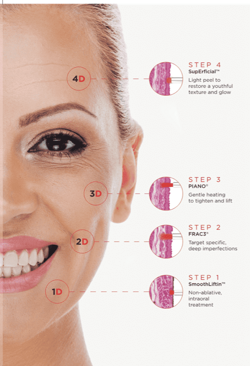 A close up of a woman 's face with a diagram showing the steps of a facial treatment.