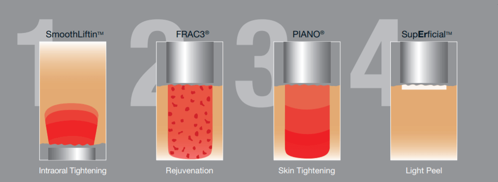A graphic showing the stages of a skin treatment.