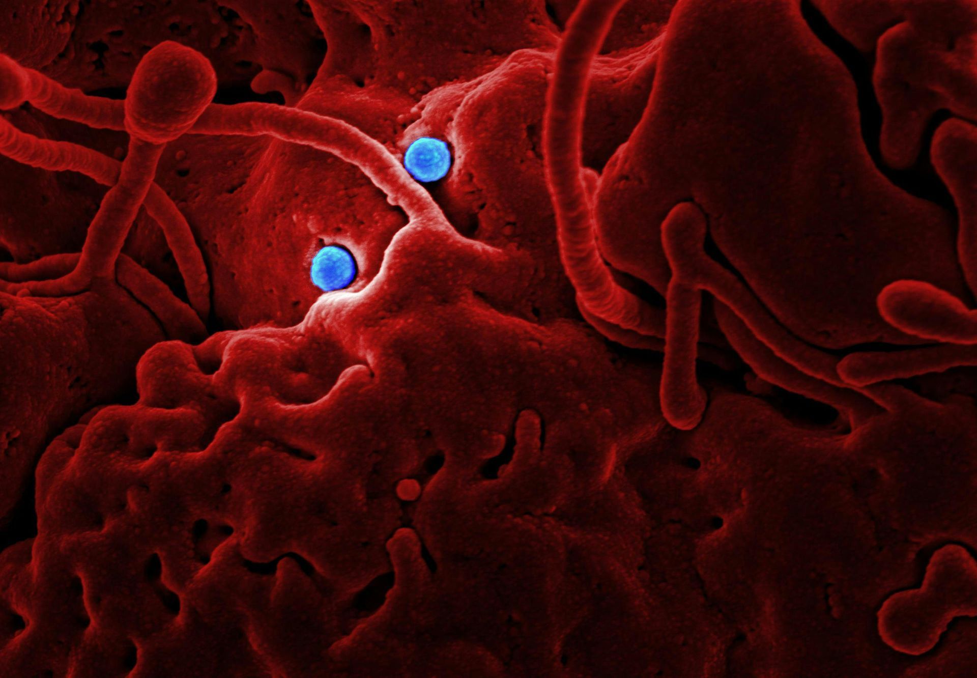 A close up of a red and blue bacteria under a microscope.