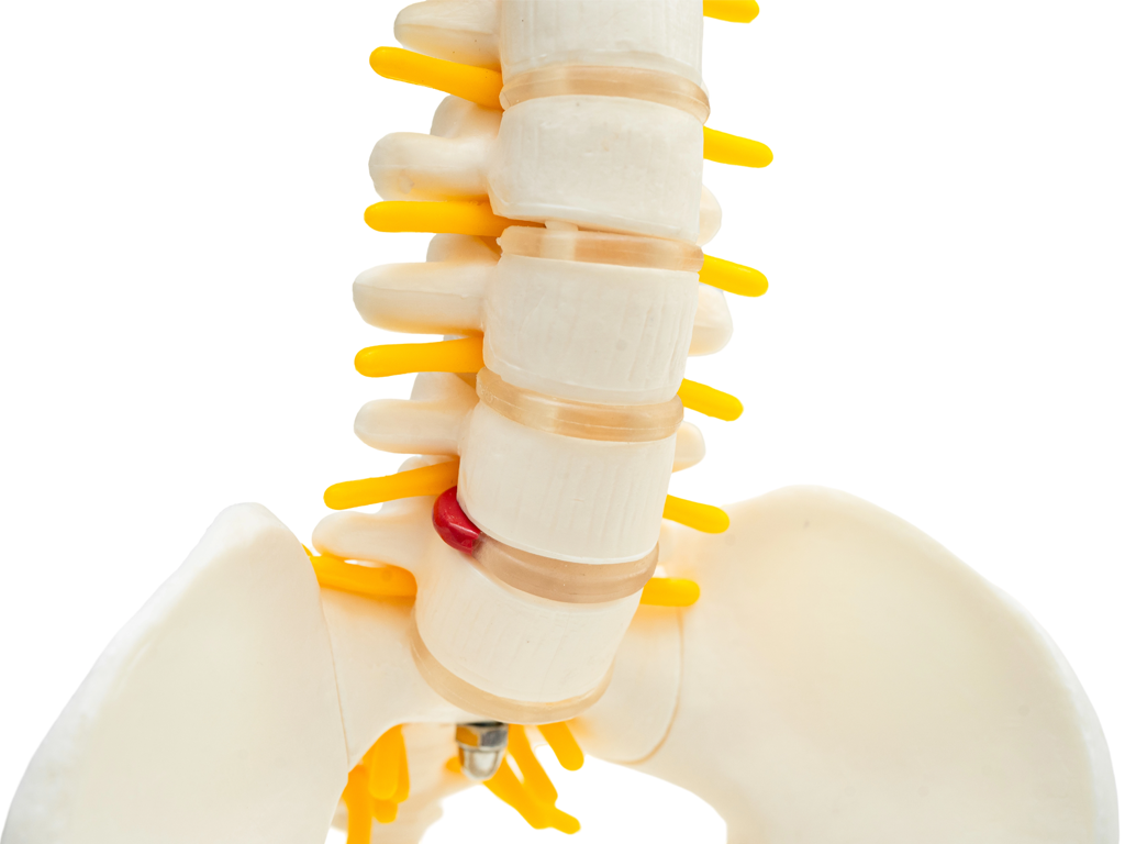 3D illustration of a human spine model with pelvis and yellow spinal nerve branches